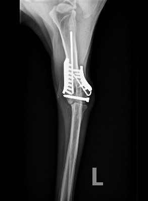 Fracture Repair
