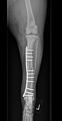 Fracture Repair